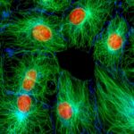 NIH 3T3 Mouse Fibroblast Cells (large orange nucleus with many green shoots coming off)